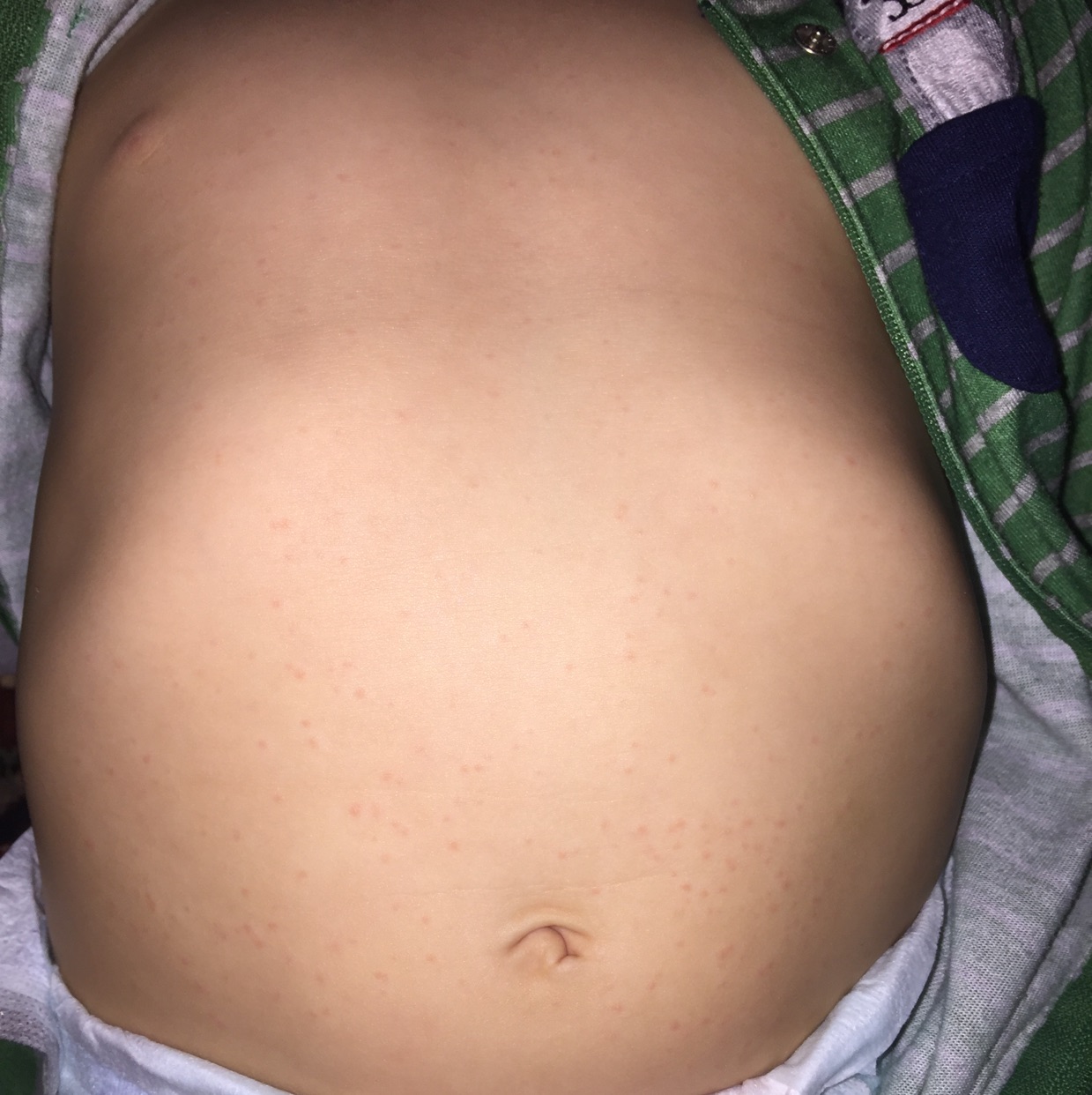 baby soap for rashes