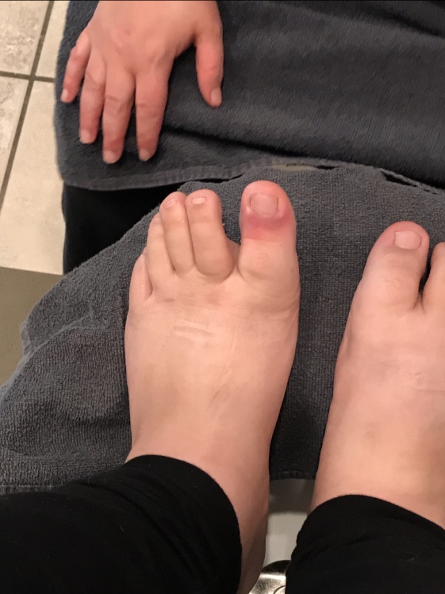 Foot Issues during 2nd Trimester Glow Community