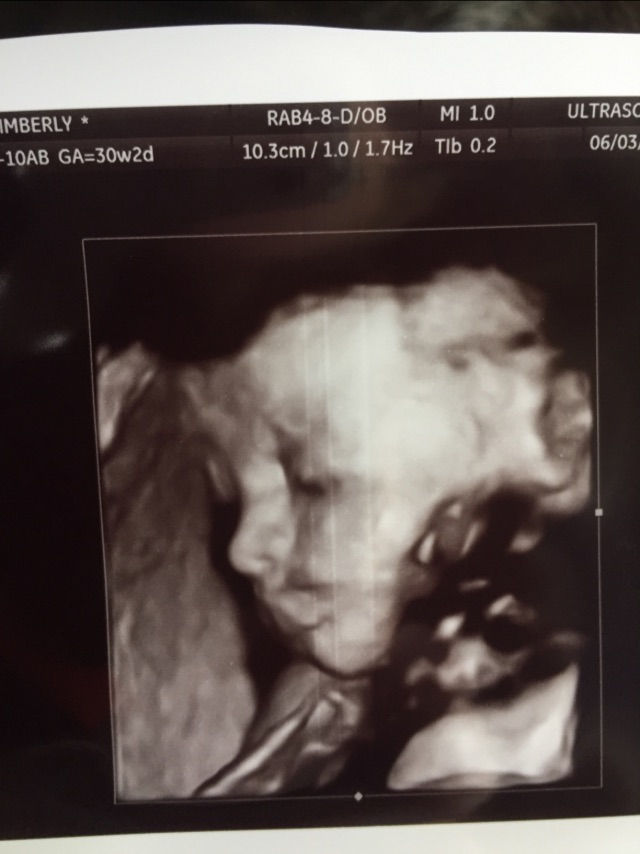 Her 30 week 3d ultrasound! - Glow Community
