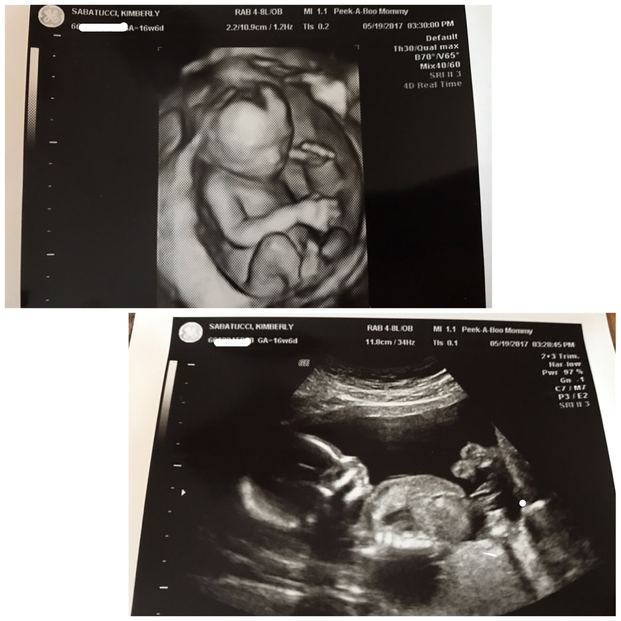 17 Week Ultrasound!💙💗 We have the gender but we won't find out until we