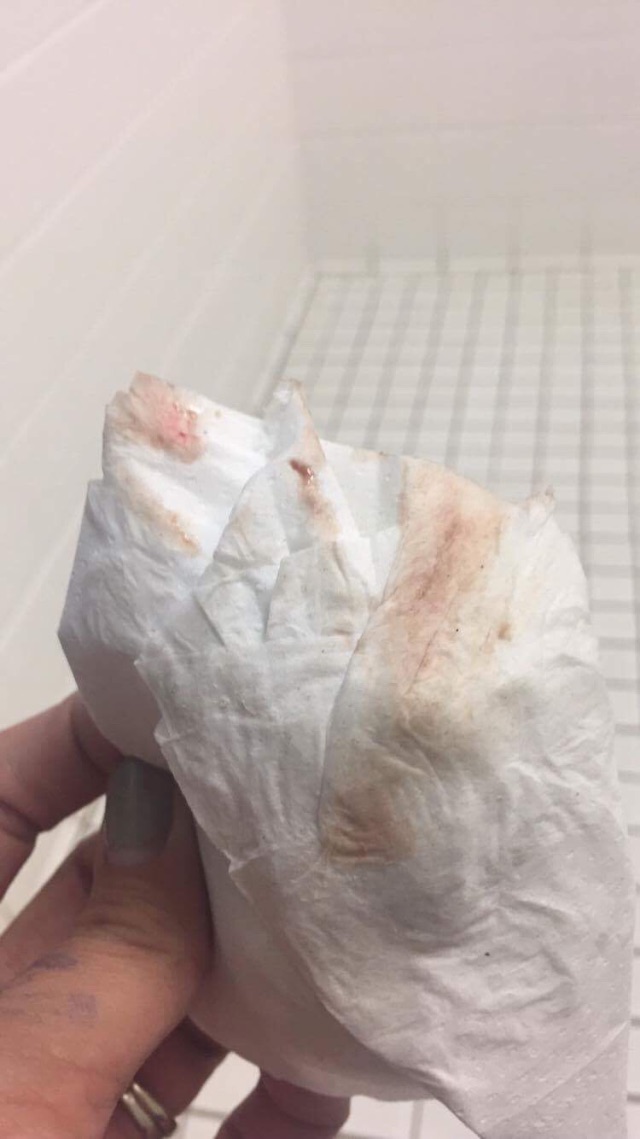 WARNING!!!!! Implantation Bleeding? Pregnant? Glow Community