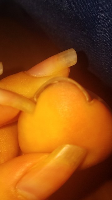 Is This An Ingrown Toenail Also Dont Mind My Ugly Fingernails Toe is-this-an-ingrown-toenail-also-dont-mind-my-ugly-fingernails-toe