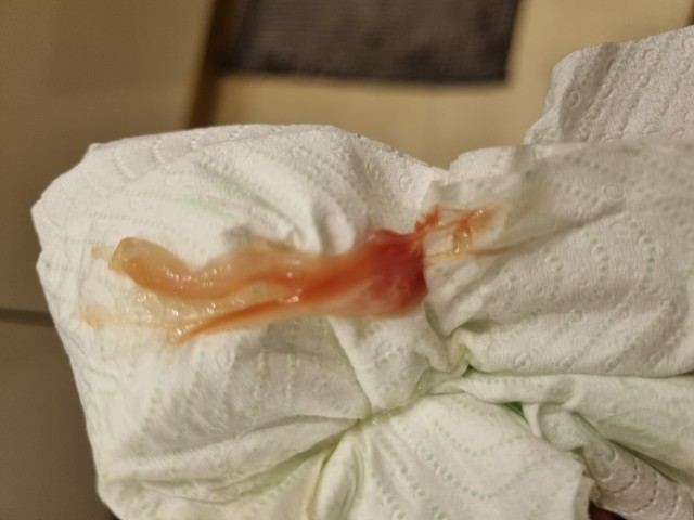 Cervix Exam 31 Weeks Mucus Plug Should I Be Worried Glow Community