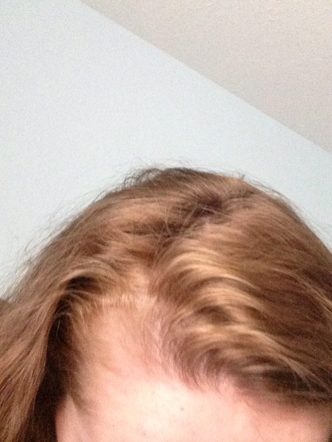 How Bad Is It Glow Community