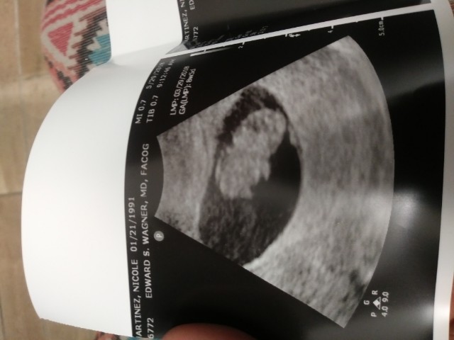 8 weeks 6 days - Ultrasound Photo - Glow Community