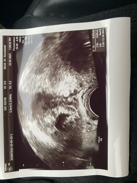 ectopic-pregnancy-tube-ligation-removal-glow-community