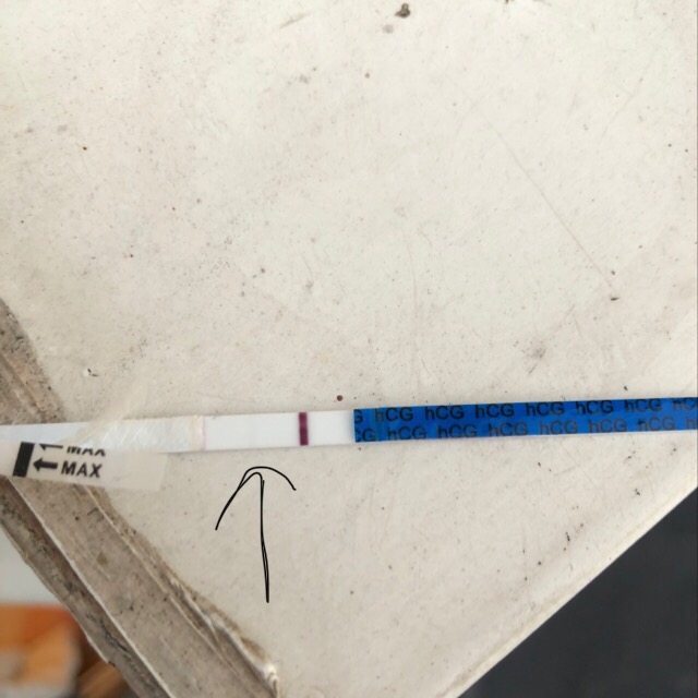 11dpo Morning Urine Can Anyone See The Faint Line Only Can See It In 