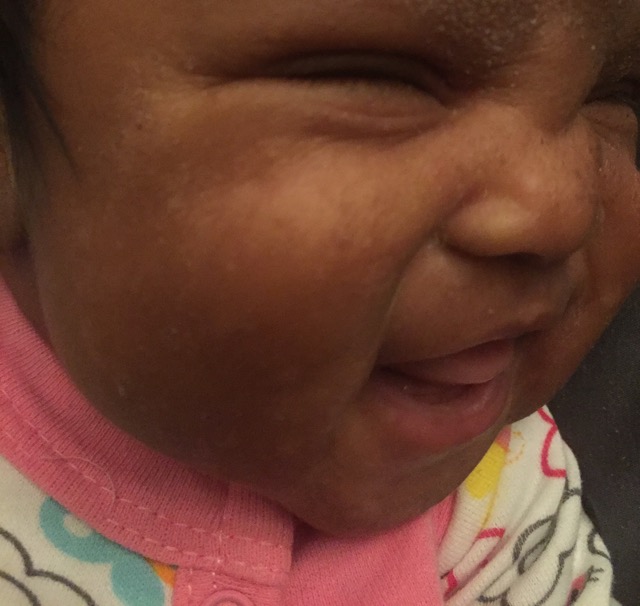 light spots just appeared on her face glow community light spots on baby face