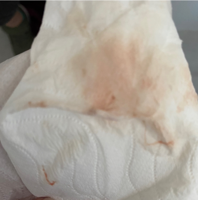 calling-all-mommas-who-experienced-implantation-bleeding-glow-community