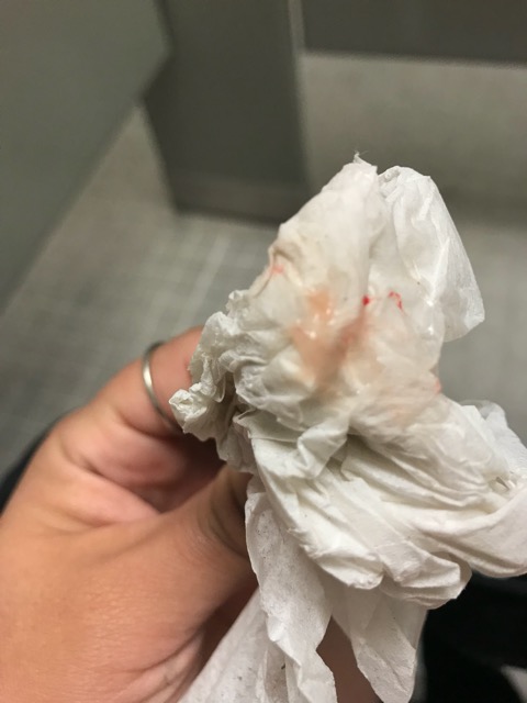 This Can t Be Implantation Bleeding Right Glow Community