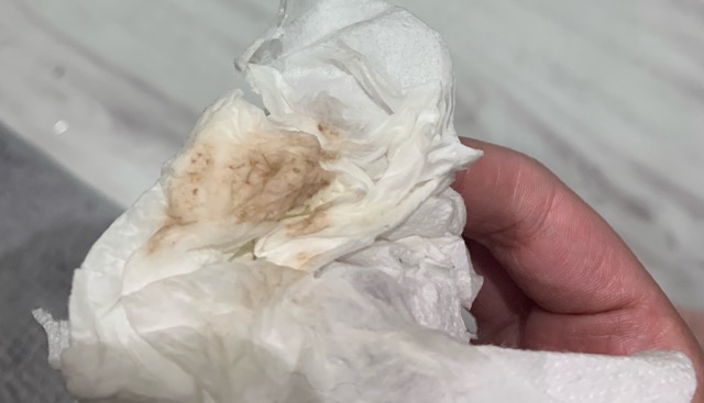Help Pregnancy Scare Is This Spotting Before Period Or Implantation 