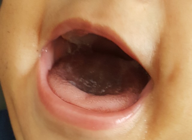 Tmi Black Tongue Glow Community