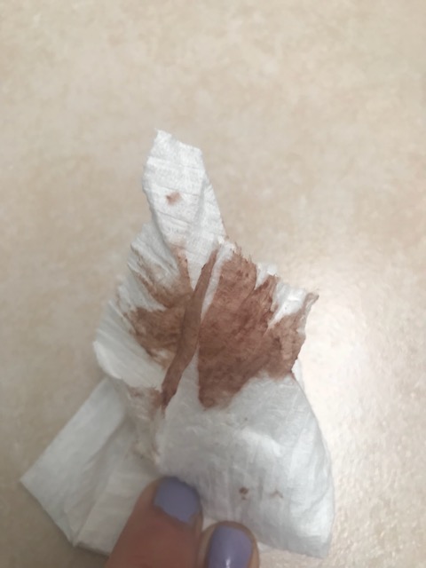 Dark Brown Discharge In Early Pregnancy 5 Weeks