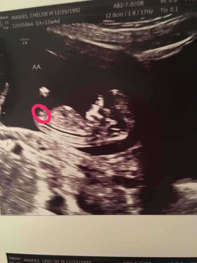 nub theory on twin A!? (no idea if this is the nub haha) Glow Community