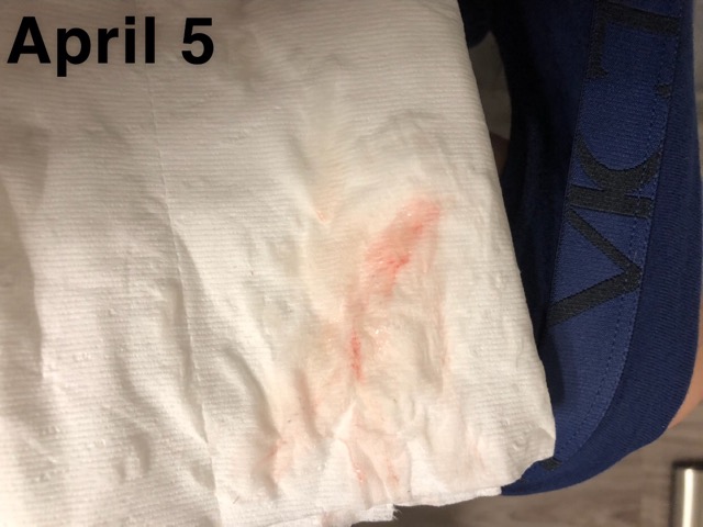 Can This Be Implantation Bleeding Glow Community