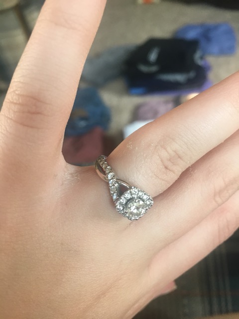 Help Skin Peeling Around Engagement Ring Glow Community Help Skin Peeling Around Engagement Ring Glow Community