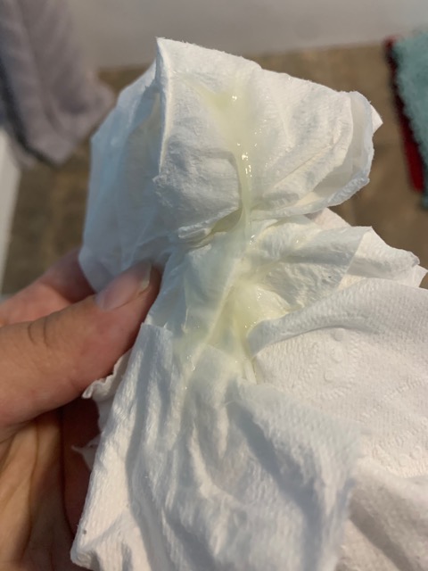 Part of mucus plug? - Glow Community
