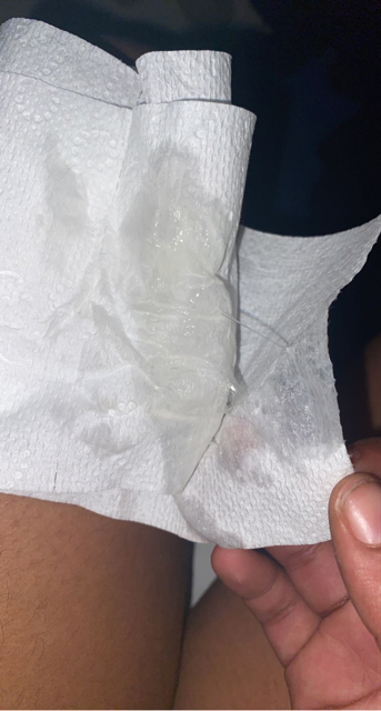Thick Egg White Discharge AFTER Ovulation Has Occurred Glow Community