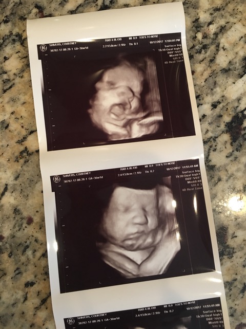 4d ultrasound at 36 weeks - Glow Community