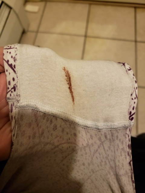 Implantation Bleeding Glow Community