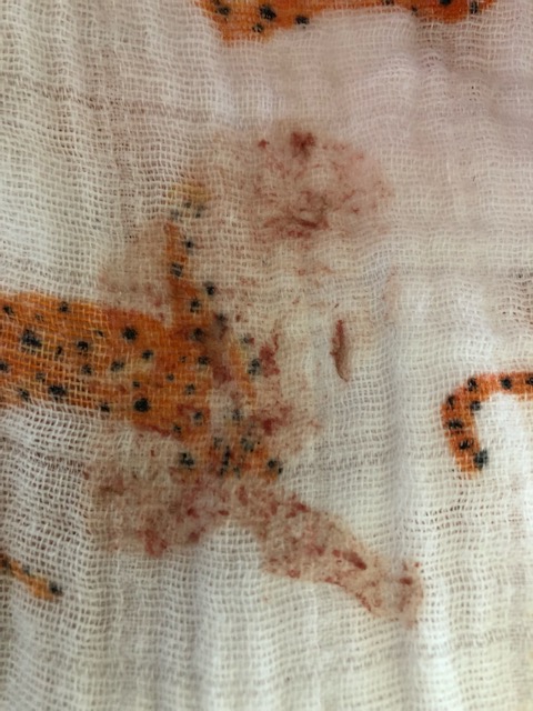 Baby Spit Up Blood Has Anybody Experienced This I Was Feeding Lo On My Breast That Has Had A Regular Bleb For A Few Weeks Now But Not Bled Took Lo Off Baby Spit Up Blood Has Anybody Experienced This I Was Feeding Lo On My Breast That Has Had A Regular Bleb For A Few Weeks Now But Not Bled Took Lo Off