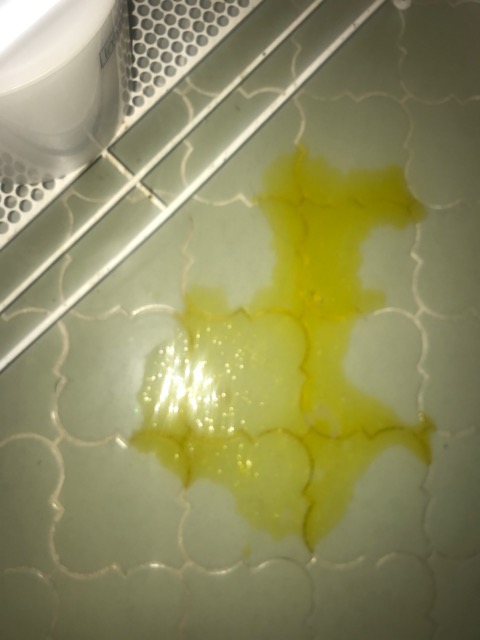 I Took An Antibiotic And After 10 Minutes I Threw This Up It s Nothing 