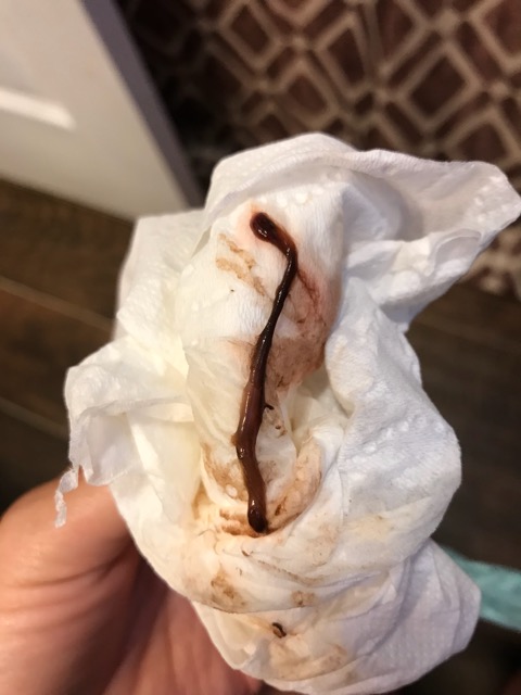 Brown Spotting Between Periods On Pill 2025